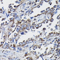 GSTK1 Antibody