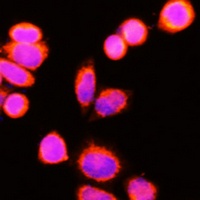 GSTK1 Antibody