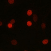 Anti-SETD8 Antibody