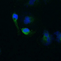 Anti-BACE1 Antibody