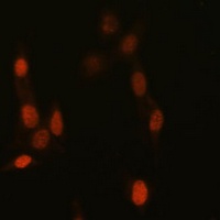 Anti-Histone H3 (TriMethyl-K14) Antibody