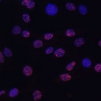 Anti-Histone H3 (TriMethyl-K14) Antibody