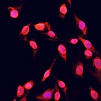 Anti-Histone H3 (TriMethyl-K14) Antibody