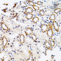 Anti-RSK2 Antibody