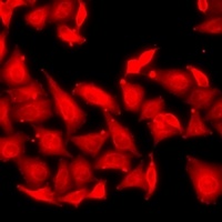 Anti-RSK2 Antibody