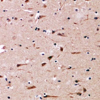 Anti-MGP Antibody