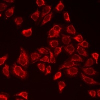 MB antibody