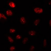 Anti-DNMT1 Antibody