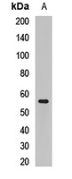 CBX4 Rabbit Polyclonal Antibody