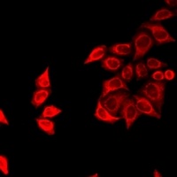 Anti-FZR1 Antibody