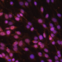 Anti-FUBP1 Antibody