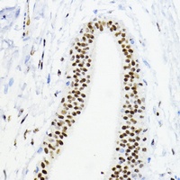 ZEB1 antibody