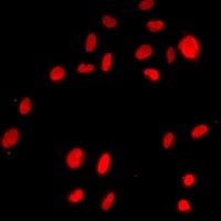 ZEB1 antibody