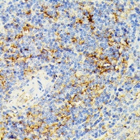 Anti-ECE1 Antibody