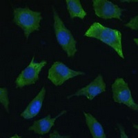 Anti-ECE1 Antibody