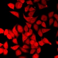 Anti-ERCC2 Antibody