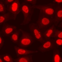 Anti-EPC1 Antibody