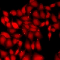 Gemin3 Rabbit Polyclonal Antibody