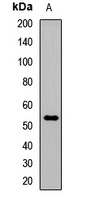 IRP Rabbit Polyclonal Antibody