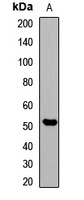 pan methyl-lysine Rabbit Polyclonal Antibody