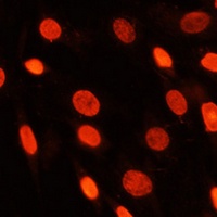 pan methyl-lysine Rabbit Polyclonal Antibody