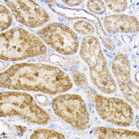 Anti-RPL4 Antibody