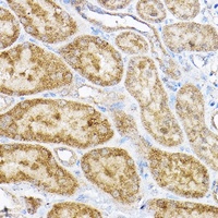 RPL4 antibody