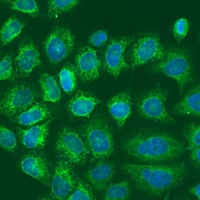 Anti-Metadherin Antibody