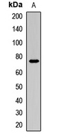 FUS Rabbit Polyclonal Antibody