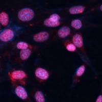 FUS Rabbit Polyclonal Antibody
