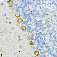Anti-RPL10A Antibody