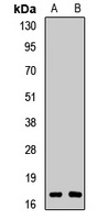 RBM3 Antibody