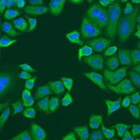 Anti-PABPC4 Antibody