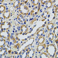 Anti-TRMT2A Antibody