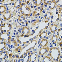 TRMT2A antibody