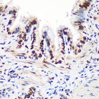 Anti-THOC4 Antibody