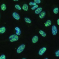 Anti-THOC4 Antibody