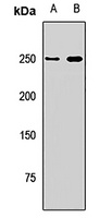 Dicer Rabbit Polyclonal Antibody