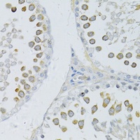 Anti-PIWIL2 Antibody