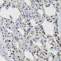 Anti-PRPF4 Antibody