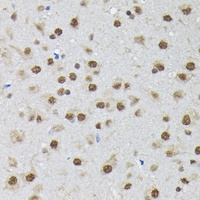 Anti-PTBP2 Antibody