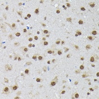 PTBP2 antibody