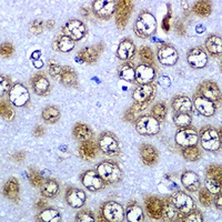 Anti-RPS10 Antibody