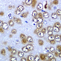 RPS10 antibody