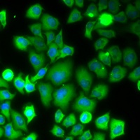 Anti-RPS10 Antibody