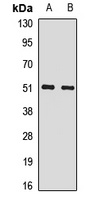 SNRNP70 Antibody