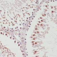 SNRNP70 antibody
