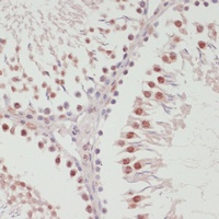 Anti-SNRNP70 Antibody