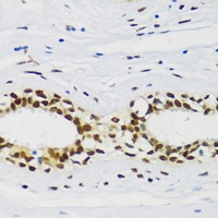 CIRBP Antibody