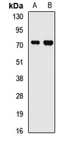 FMR1 Rabbit Polyclonal Antibody